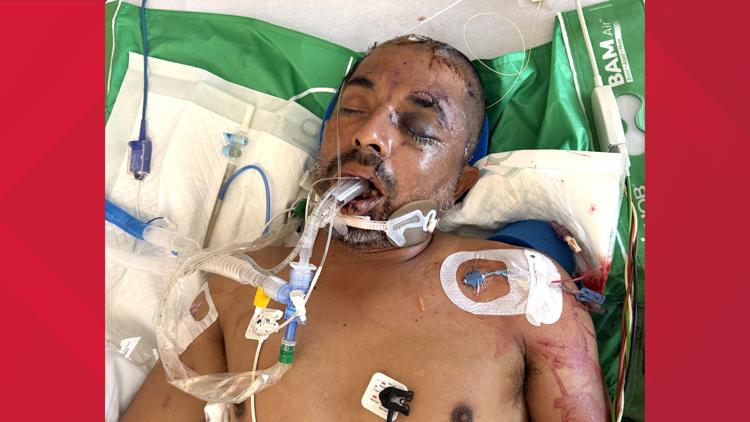 University Hospital asks for help identifying unconscious patient hit by truck Saturday evening — KENS 5 (San Antonio), Menlo Park Health news